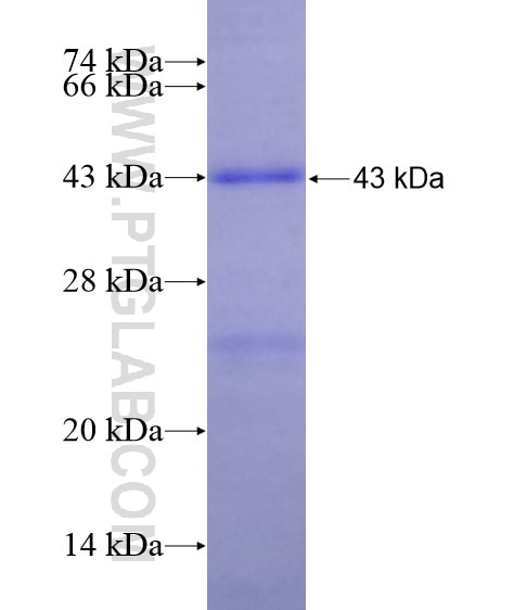 PRMT1 fusion protein Ag29063 SDS-PAGE