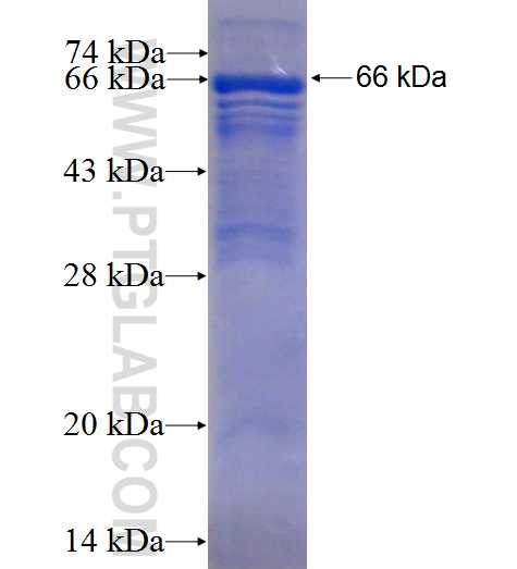 PRMT1 fusion protein Ag1790 SDS-PAGE