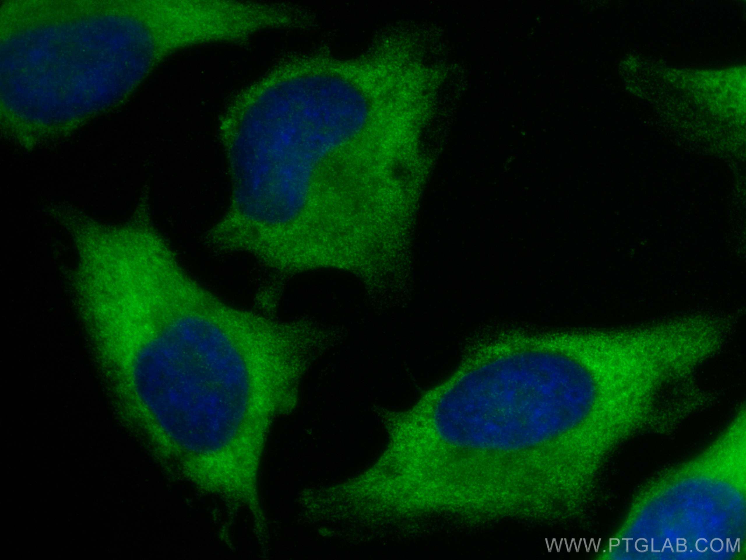 Immunofluorescence (IF) / fluorescent staining of HeLa cells using PRMT2 Monoclonal antibody (66885-1-Ig)