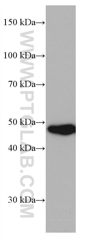 WB analysis of SKOV-3 using 66885-1-Ig