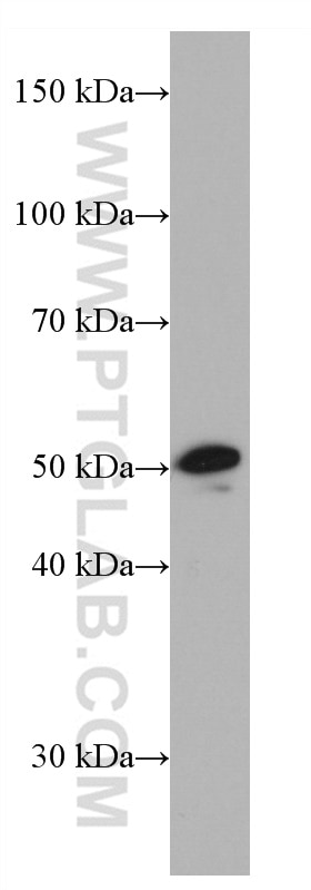 Western Blot (WB) analysis of rat heart tissue using PRMT2 Monoclonal antibody (66885-1-Ig)