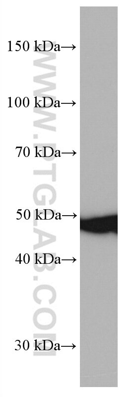 Western Blot (WB) analysis of LNCaP cells using PRMT2 Monoclonal antibody (66885-1-Ig)