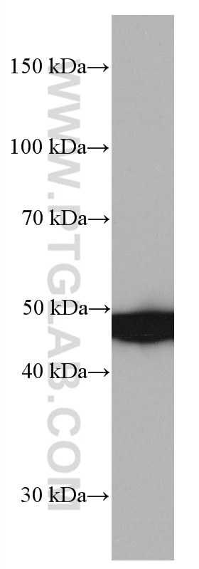 Western Blot (WB) analysis of Jurkat cells using PRMT2 Monoclonal antibody (66885-1-Ig)