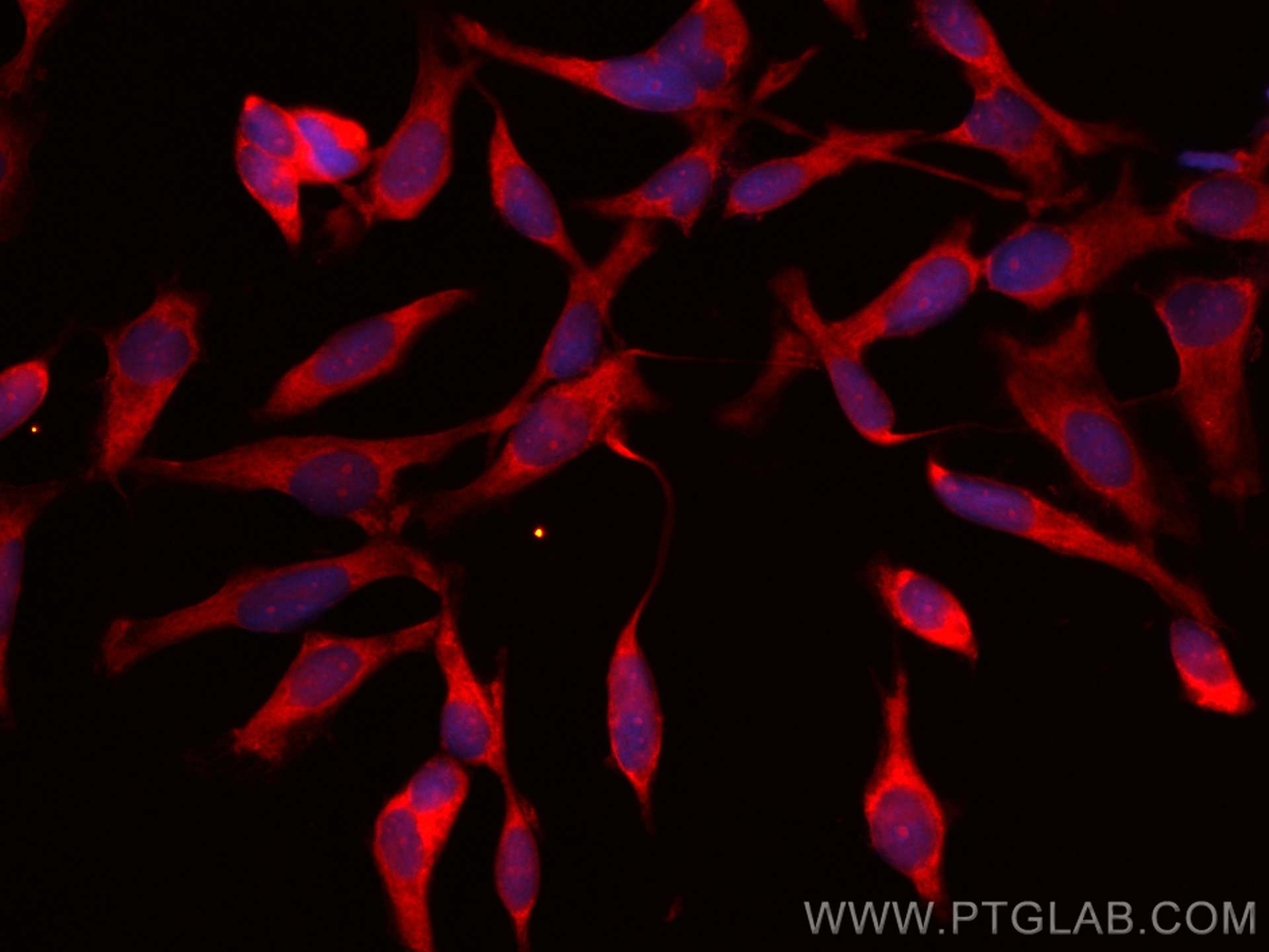 Immunofluorescence (IF) / fluorescent staining of HeLa cells using CoraLite®594-conjugated PRMT2 Monoclonal antibody (CL594-66885)