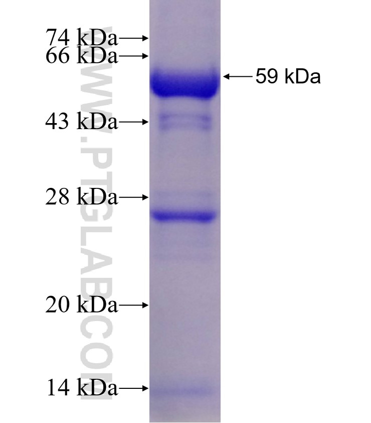 PRMT2 fusion protein Ag1806 SDS-PAGE