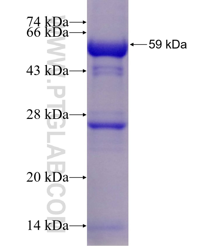 PRMT2 fusion protein Ag1806 SDS-PAGE