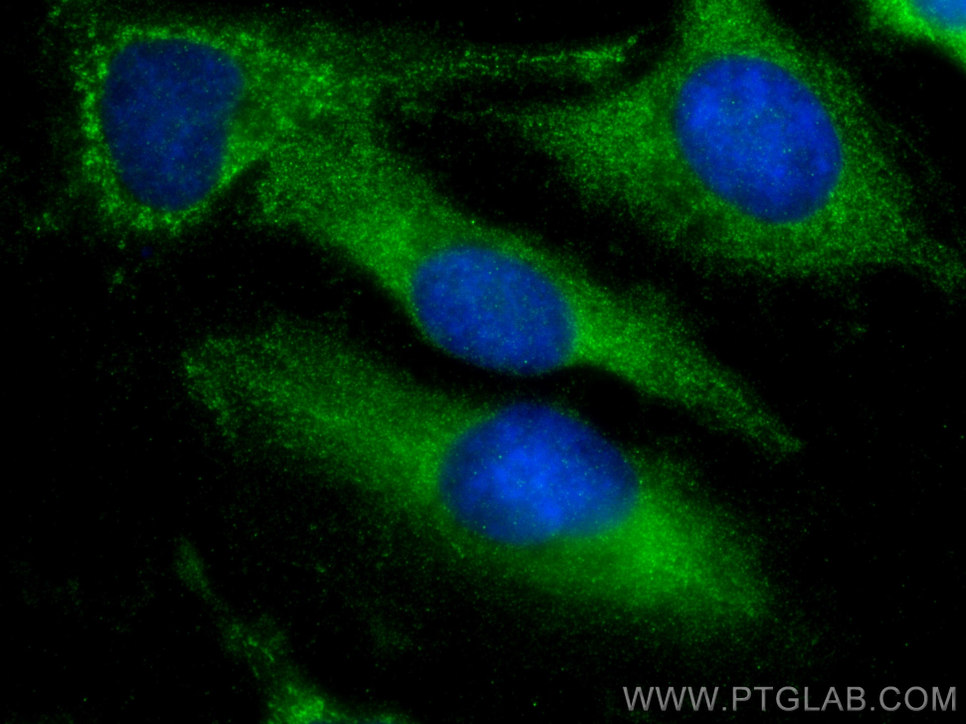 Immunofluorescence (IF) / fluorescent staining of HeLa cells using PRMT3 Polyclonal antibody (17628-1-AP)