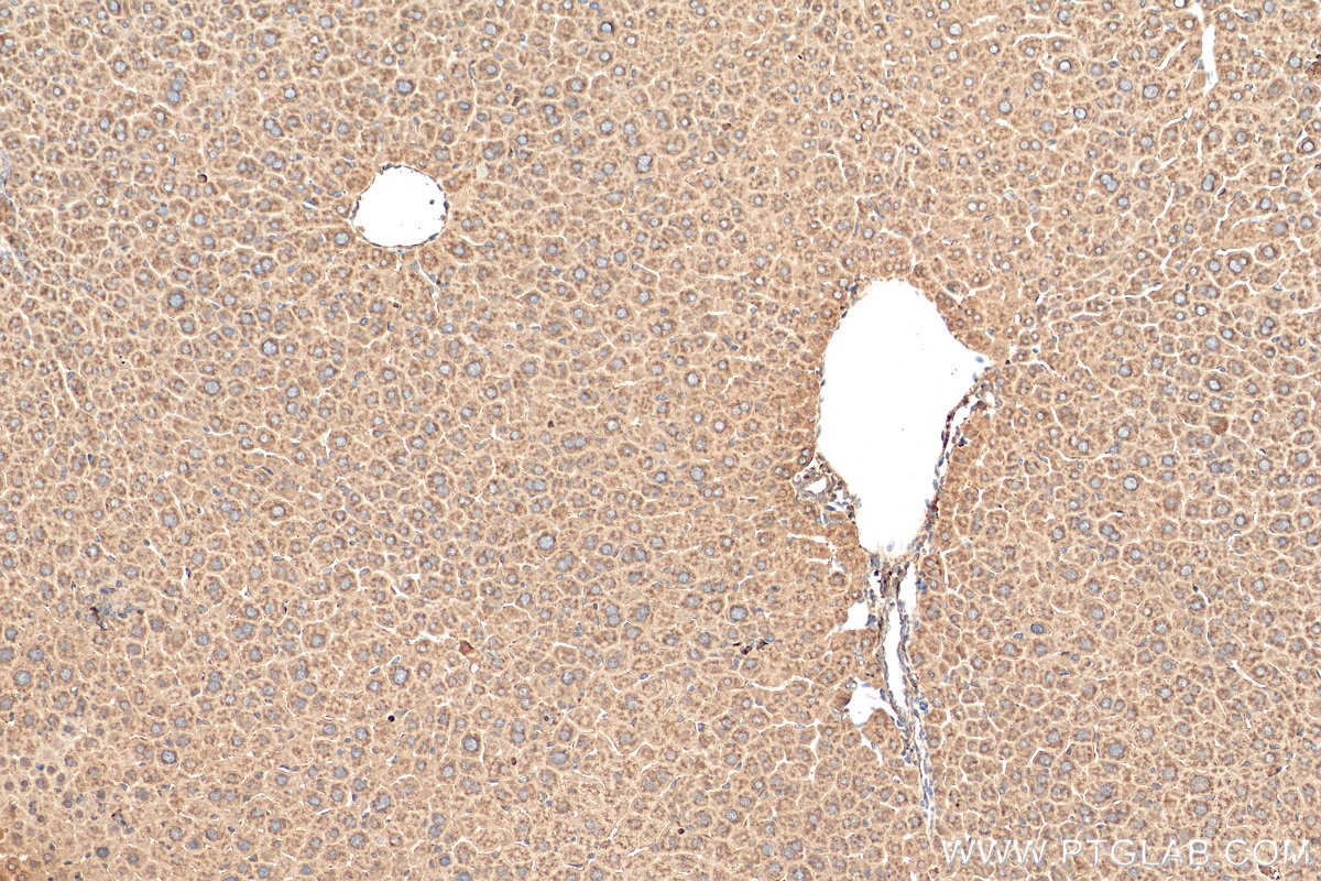 Immunohistochemistry (IHC) staining of mouse liver tissue using PRMT3 Polyclonal antibody (17628-1-AP)