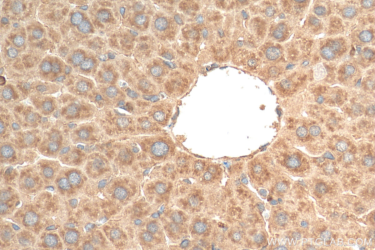 Immunohistochemistry (IHC) staining of mouse liver tissue using PRMT3 Polyclonal antibody (17628-1-AP)