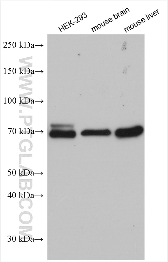 Western Blot (WB) analysis of various lysates using PRMT3 Polyclonal antibody (17628-1-AP)