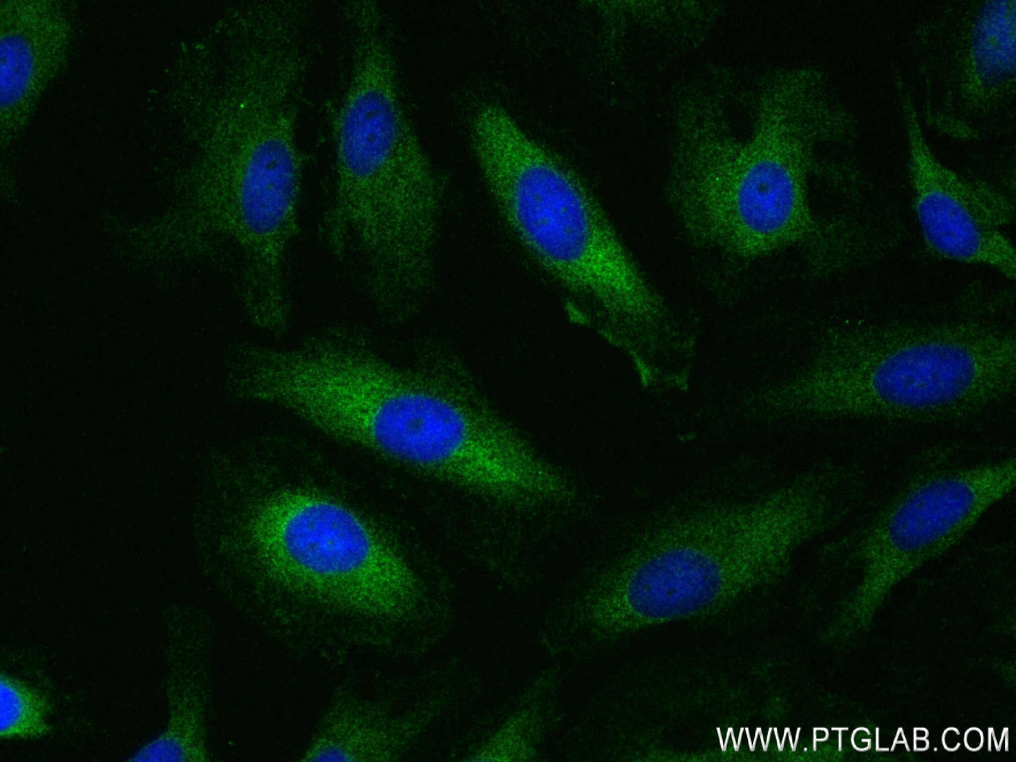 Immunofluorescence (IF) / fluorescent staining of HeLa cells using PRMT3 Recombinant antibody (83969-7-RR)