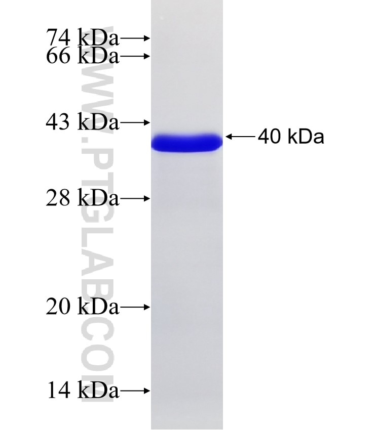 PRMT3 fusion protein Ag33118 SDS-PAGE PRMT3 fusion protein Ag33118 SDS-PAGE