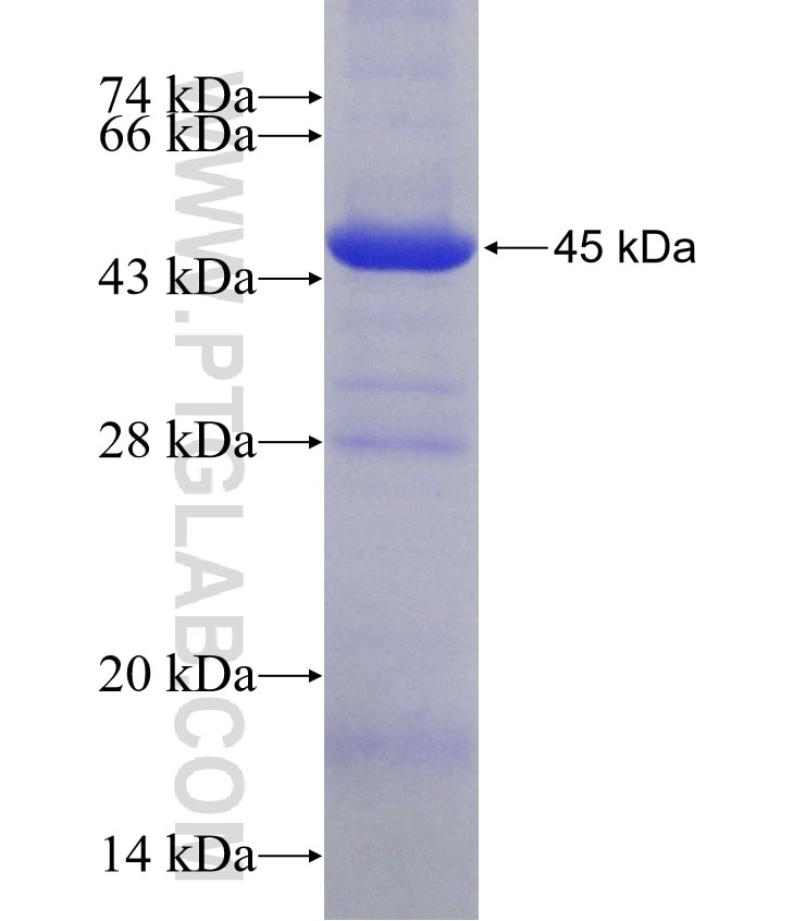 PRMT3 fusion protein Ag11877 SDS-PAGE