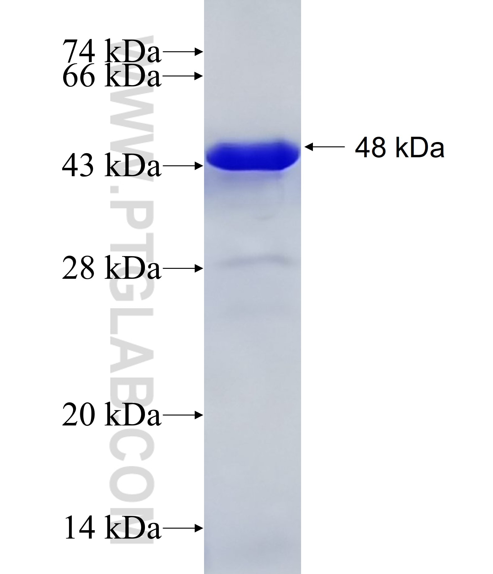 PRMT3 fusion protein Ag11877 SDS-PAGE