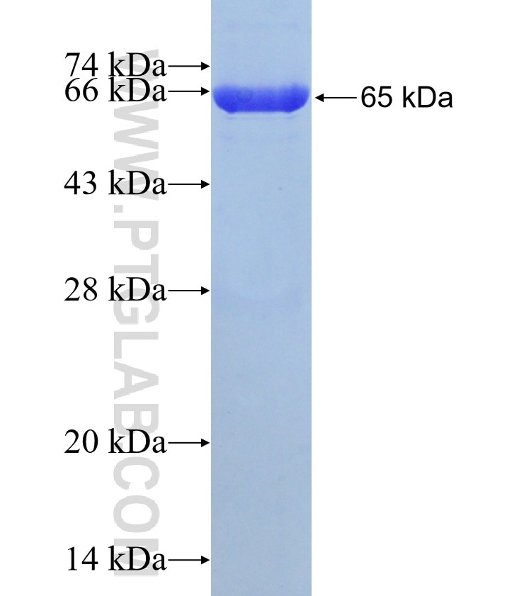 PRMT3 fusion protein Ag13466 SDS-PAGE