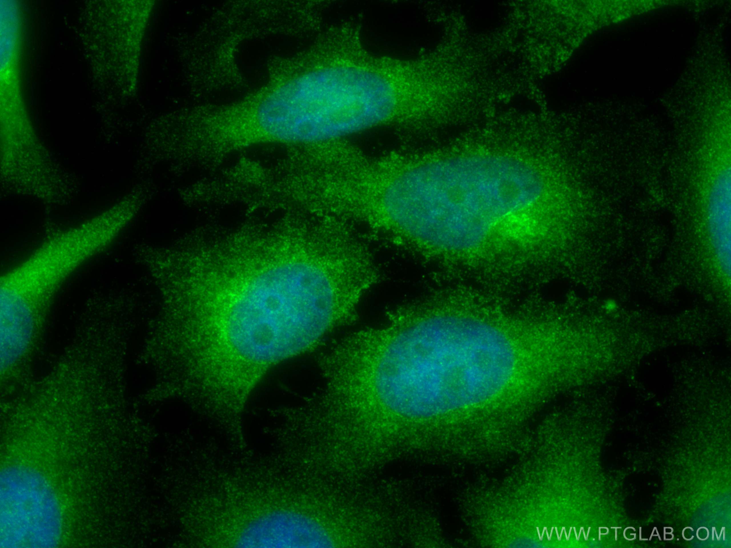 Immunofluorescence (IF) / fluorescent staining of HeLa cells using PRMT5 Polyclonal antibody (18436-1-AP)