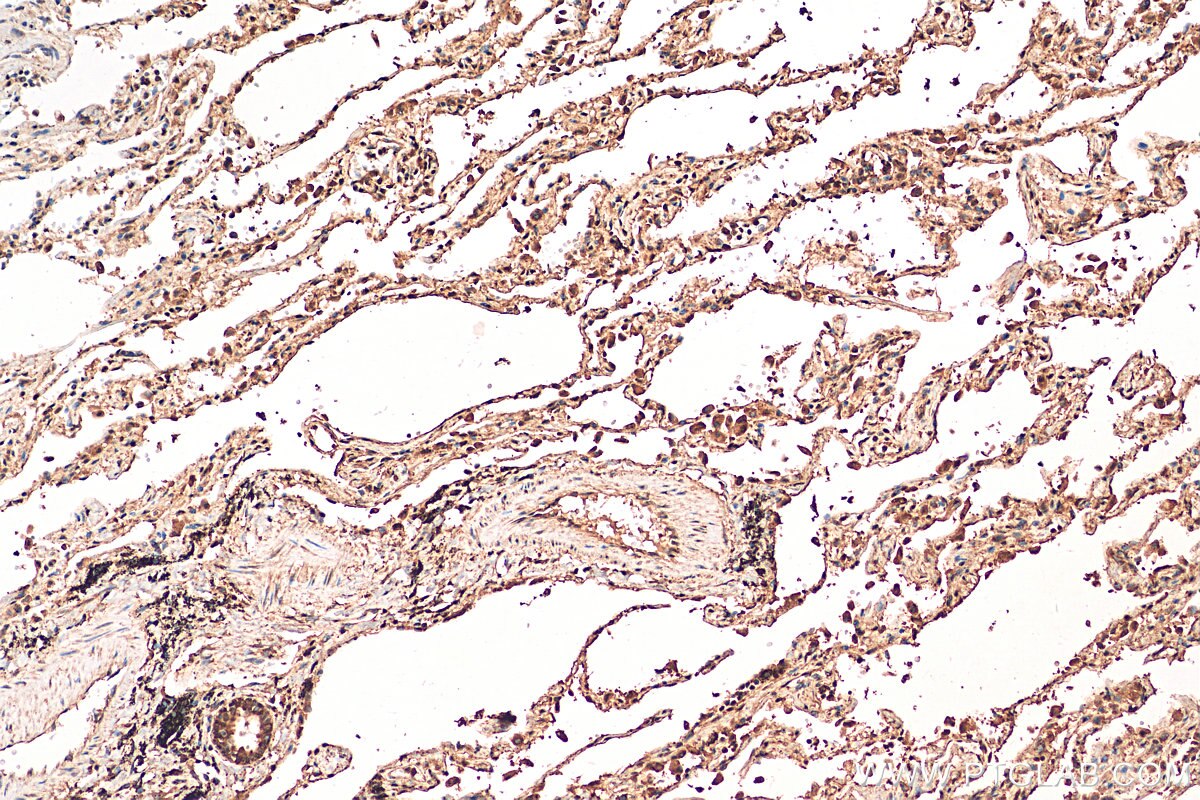 Immunohistochemistry (IHC) staining of human lung tissue using PRMT5 Polyclonal antibody (18436-1-AP)