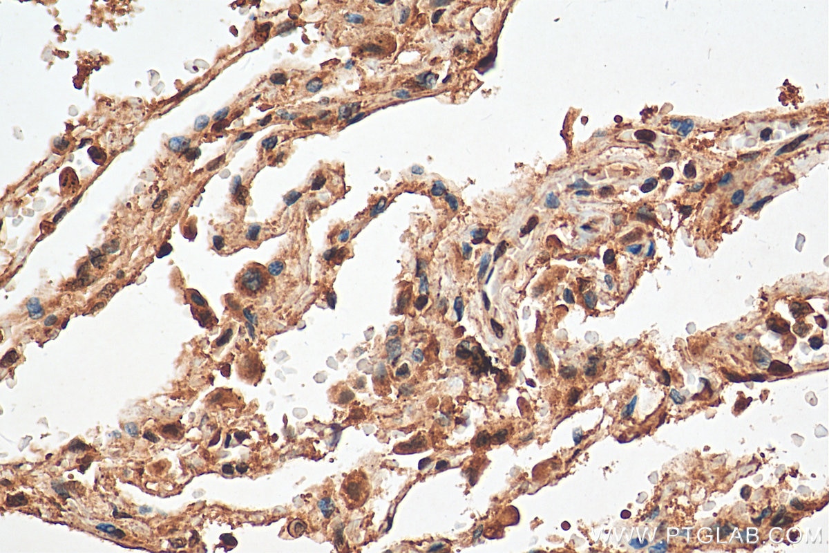 Immunohistochemistry (IHC) staining of human lung tissue using PRMT5 Polyclonal antibody (18436-1-AP)