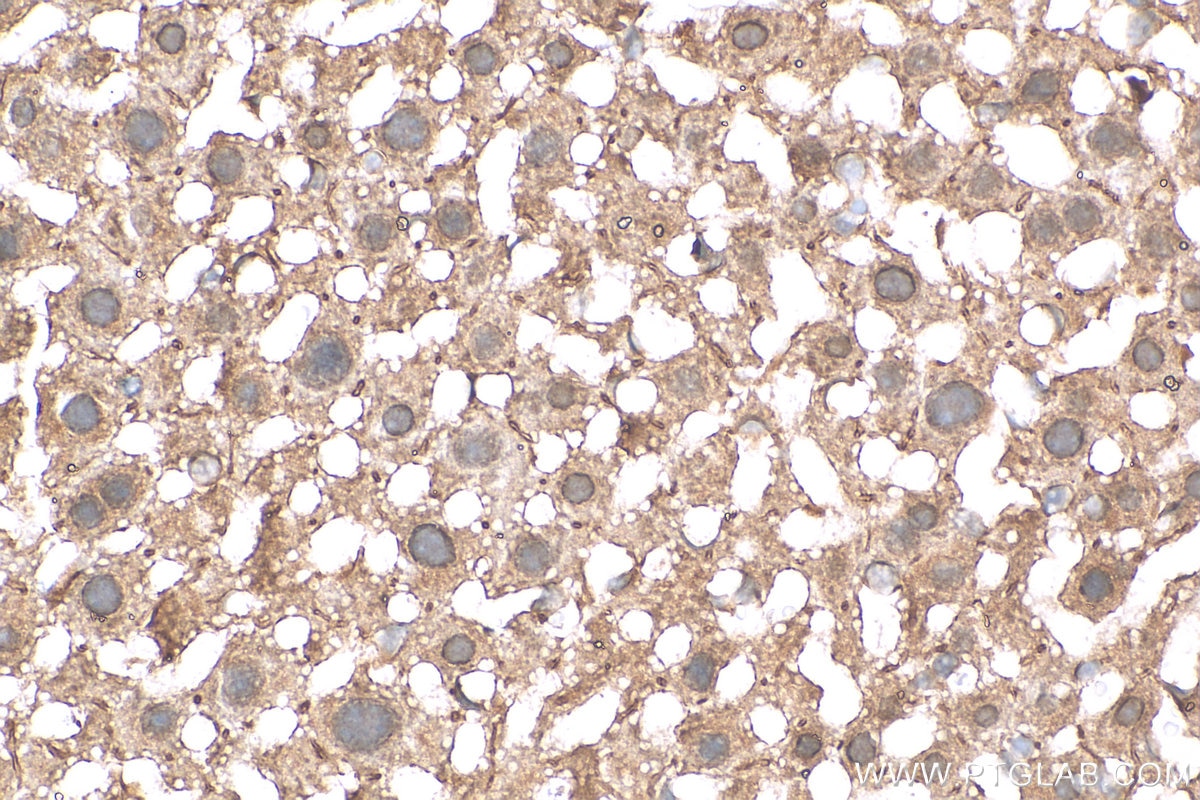 Immunohistochemistry (IHC) staining of mouse liver tissue using PRMT5 Polyclonal antibody (18436-1-AP)