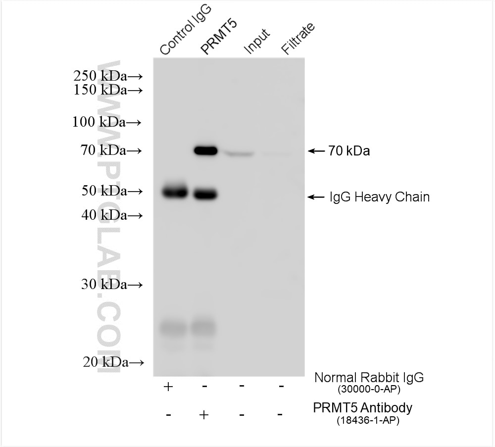 IP experiment of mouse brain using 18436-1-AP