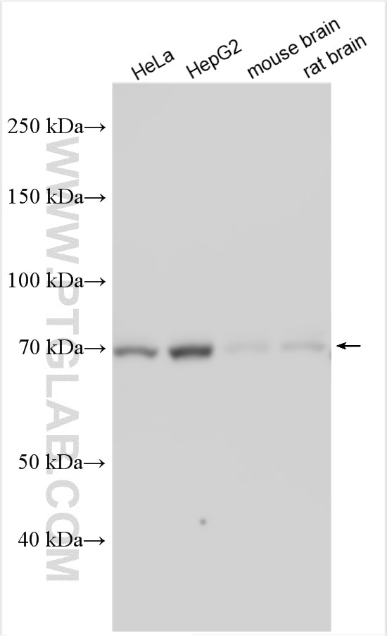 Western Blot (WB) analysis of various lysates using PRMT5 Polyclonal antibody (18436-1-AP)