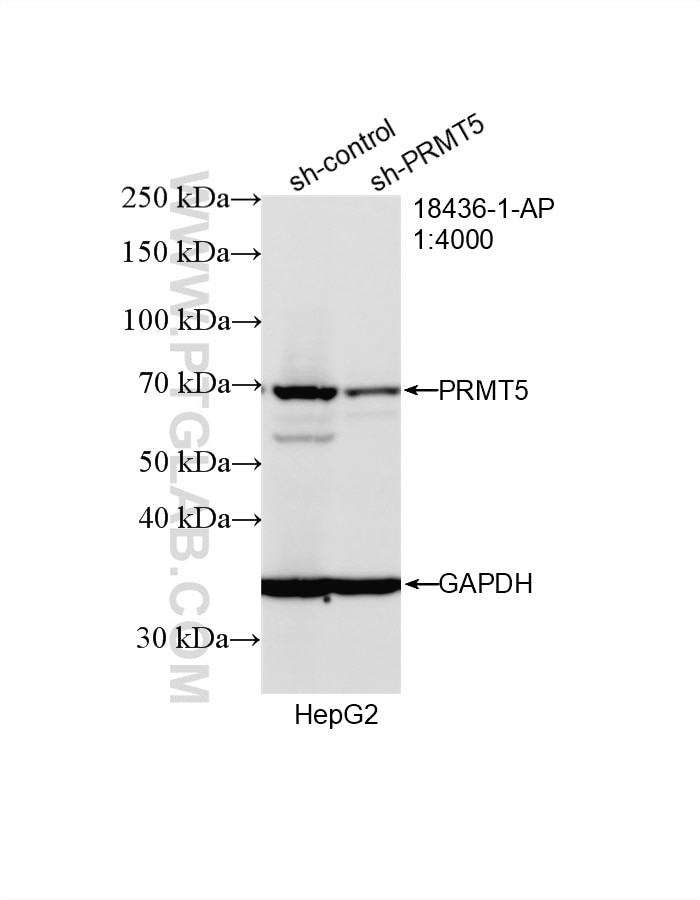 WB result of PRMT5 antibody (18436-1-AP; 1:4000; incubated at room temperature for 1.5 hours) with sh-Control and sh-PRMT5 transfected HepG2 cells. Western Blot (WB) analysis of HepG2 cells using PRMT5 Polyclonal antibody (18436-1-AP)