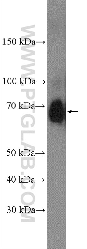 Western Blot (WB) analysis of mouse embryo tissue using PRMT5 Polyclonal antibody (18436-1-AP)