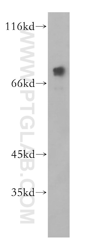 Western Blot (WB) analysis of Jurkat cells using PRMT5 Polyclonal antibody (18436-1-AP)
