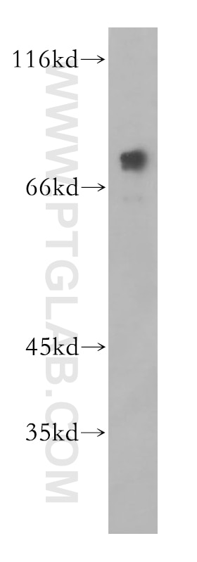 WB analysis of Jurkat using 18436-1-AP