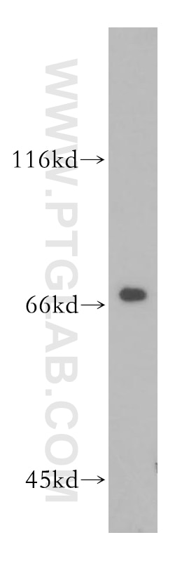 Western Blot (WB) analysis of Raji cells using PRMT5 Polyclonal antibody (18436-1-AP)