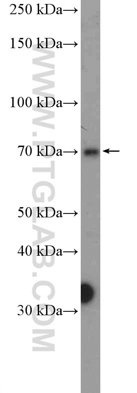 Western Blot (WB) analysis of PC-12 cells using PRMT5 Polyclonal antibody (27109-1-AP)