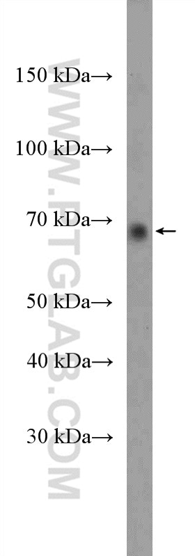 Western Blot (WB) analysis of NIH/3T3 cells using PRMT5 Polyclonal antibody (27109-1-AP)