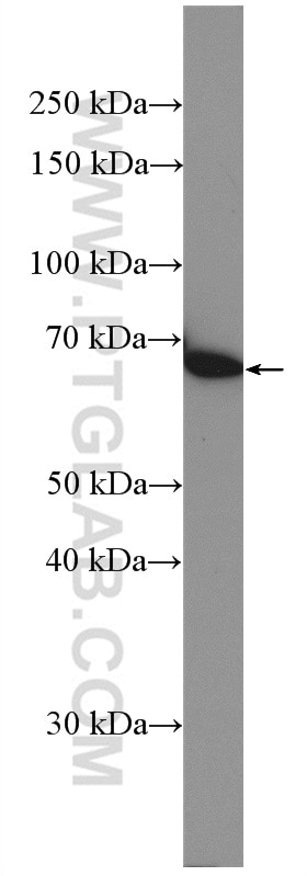 Western Blot (WB) analysis of Raji cells using PRMT5 Polyclonal antibody (27109-1-AP)