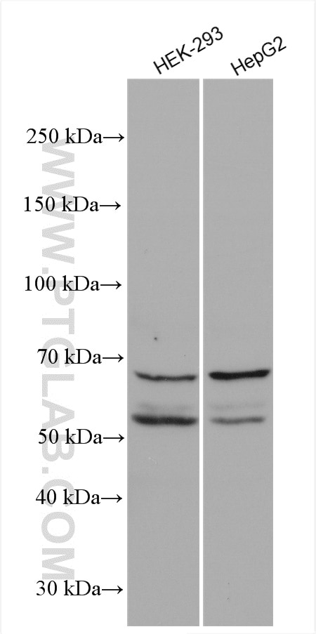 Western Blot (WB) analysis of various lysates using PRMT5 Polyclonal antibody (27109-1-AP)