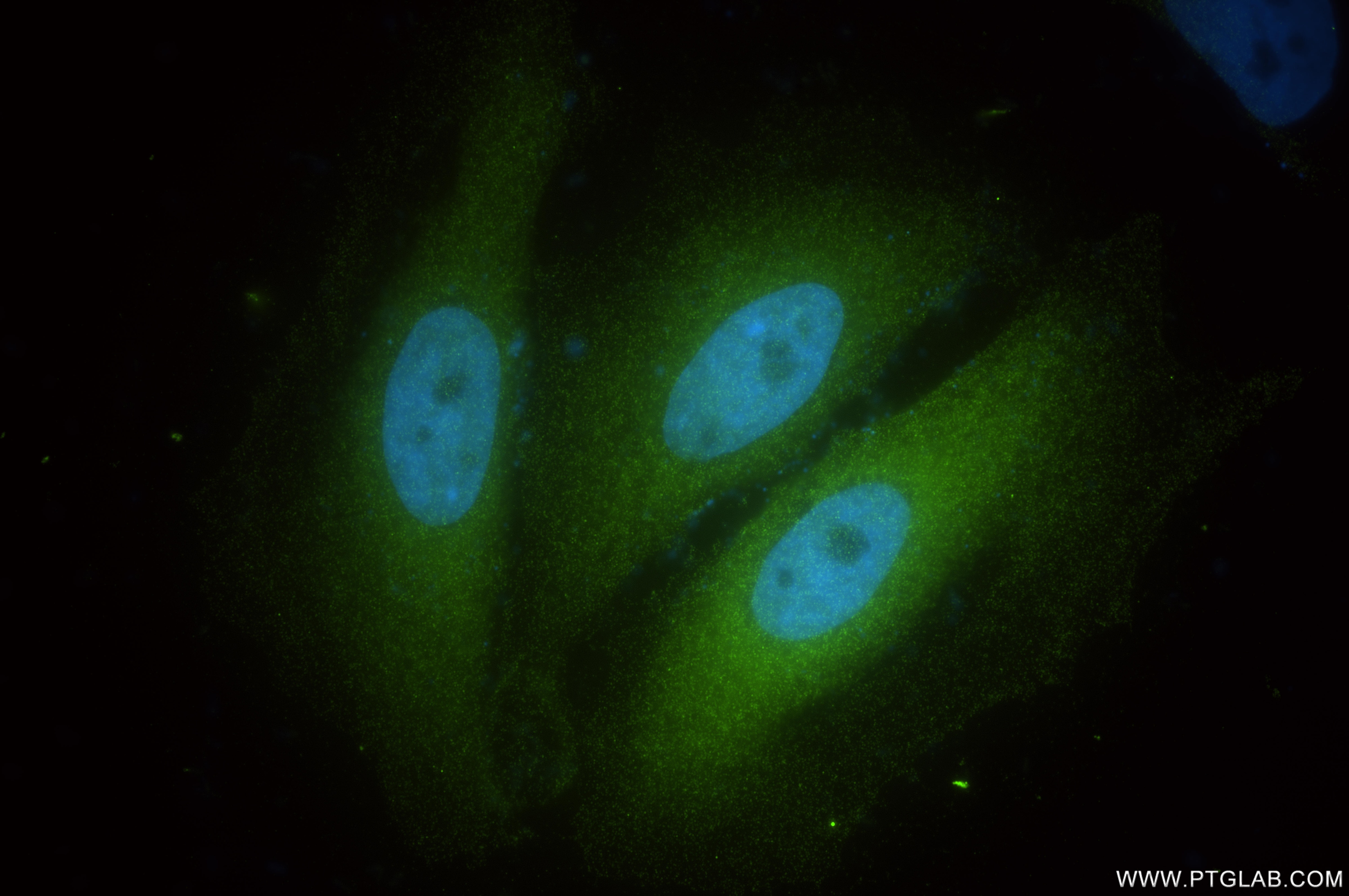 Immunofluorescence (IF) / fluorescent staining of HeLa cells using PRMT5 Recombinant antibody (82750-2-RR)
