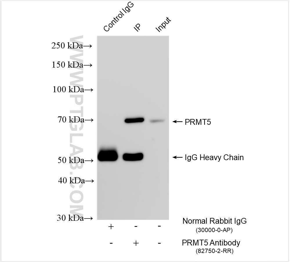 Immunoprecipitation (IP) experiment of mouse brain tissue using PRMT5 Recombinant antibody (82750-2-RR)