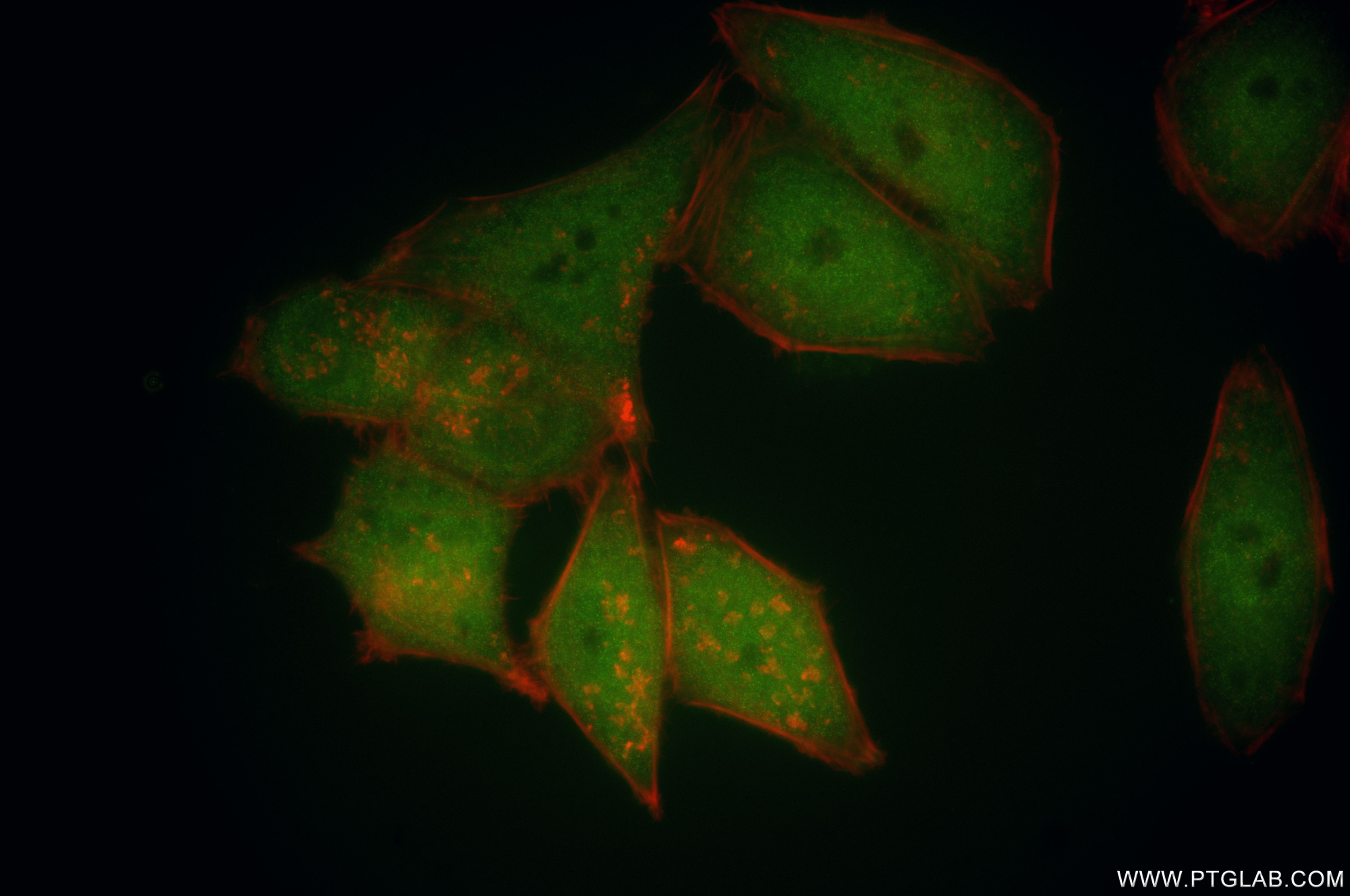 Immunofluorescence (IF) / fluorescent staining of HepG2 cells using PRMT5 Recombinant antibody (82750-3-RR)