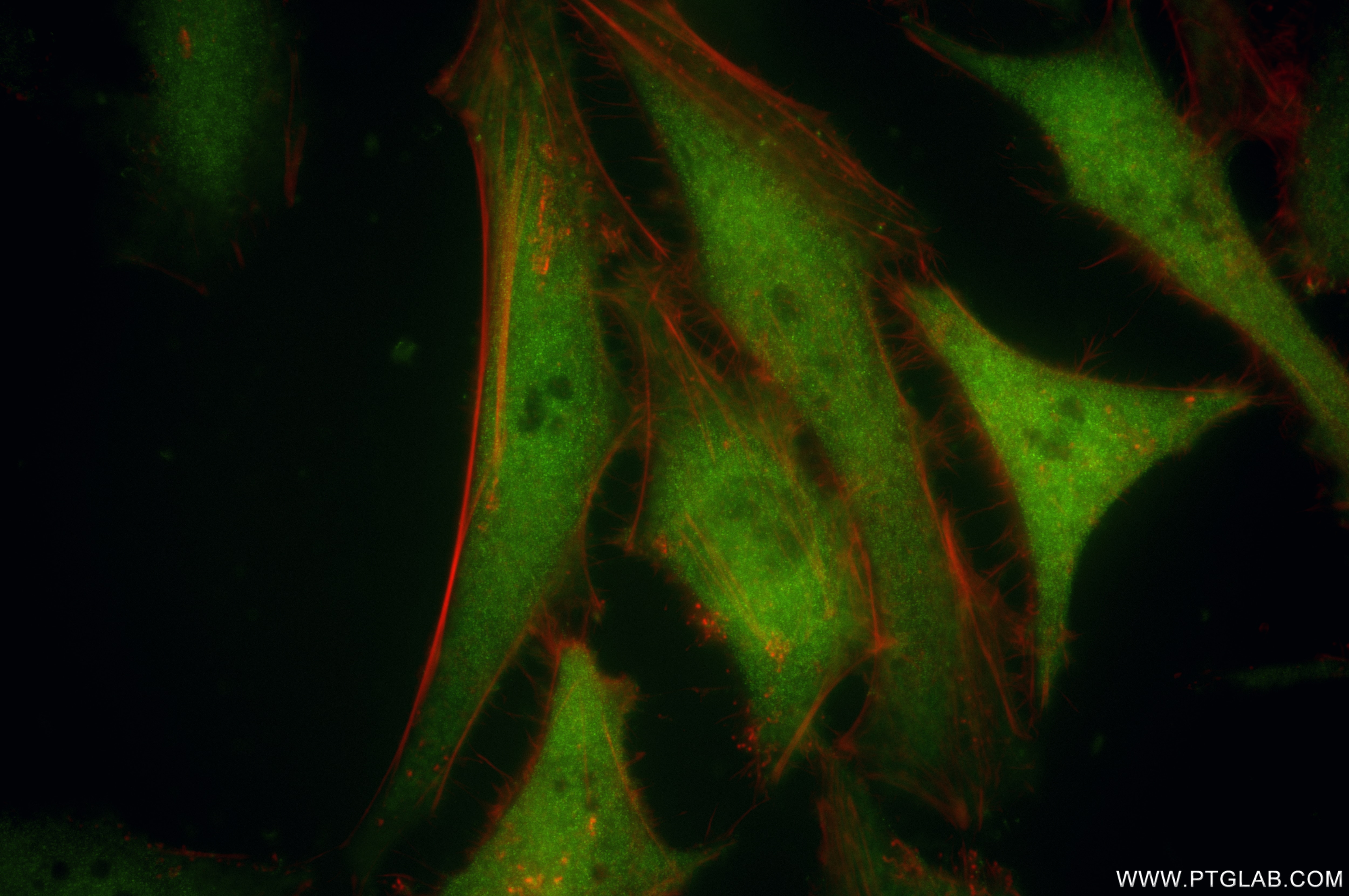 Immunofluorescence (IF) / fluorescent staining of HeLa cells using PRMT5 Recombinant antibody (82750-3-RR)