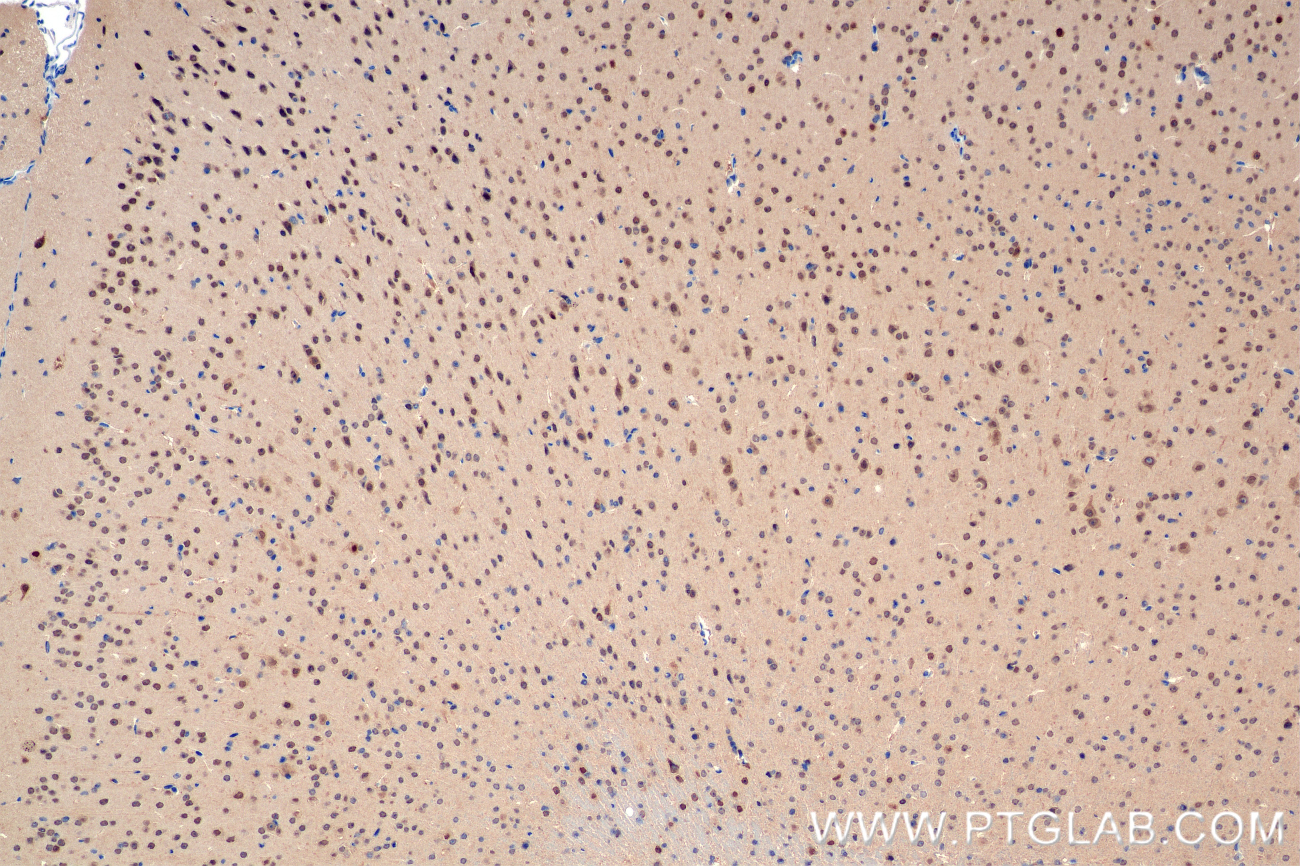 Immunohistochemical analysis of paraffin-embedded mouse brain tissue slide using 82750-3-RR (PRMT5 antibody) at dilution of 1:400 (under 10x lens). Heat mediated antigen retrieval with Tris-EDTA buffer (pH 9.0). Immunohistochemistry (IHC) staining of mouse brain tissue using PRMT5 Recombinant antibody (82750-3-RR)