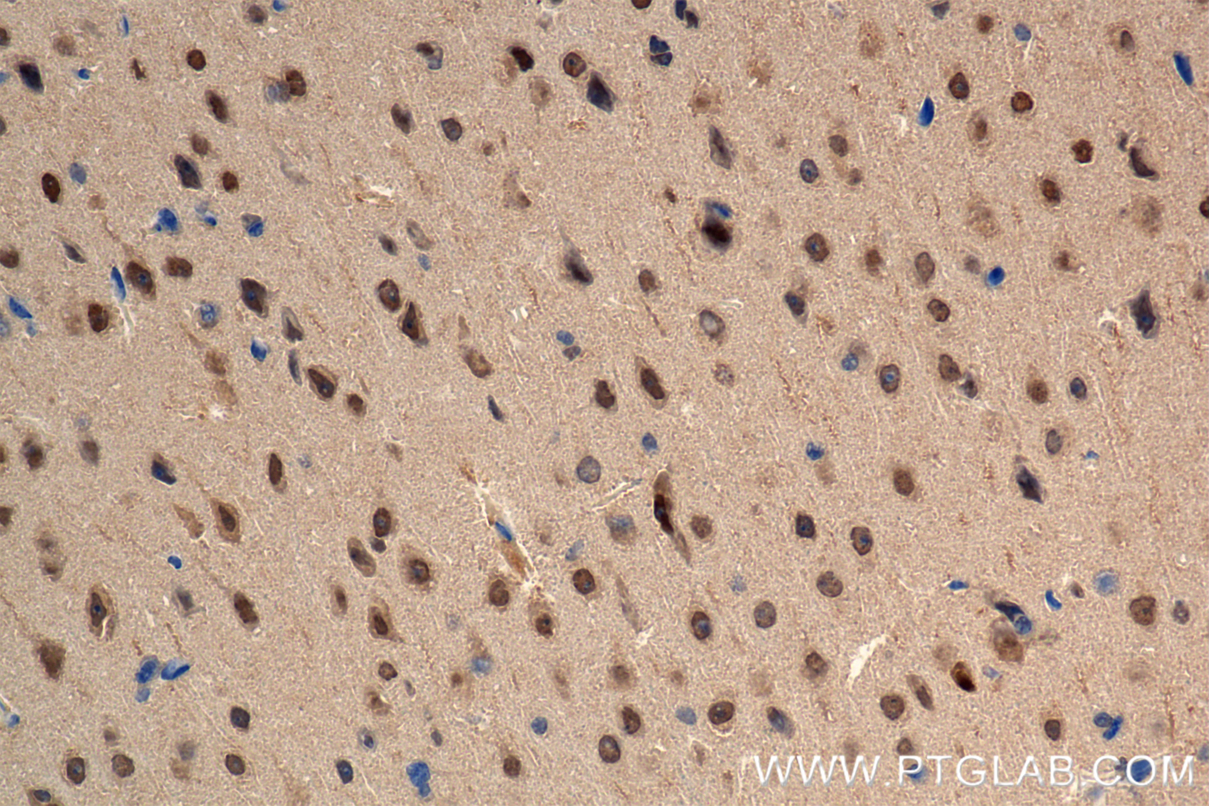 Immunohistochemical analysis of paraffin-embedded mouse brain tissue slide using 82750-3-RR (PRMT5 antibody) at dilution of 1:400 (under 40x lens). Heat mediated antigen retrieval with Tris-EDTA buffer (pH 9.0). Immunohistochemistry (IHC) staining of mouse brain tissue using PRMT5 Recombinant antibody (82750-3-RR)