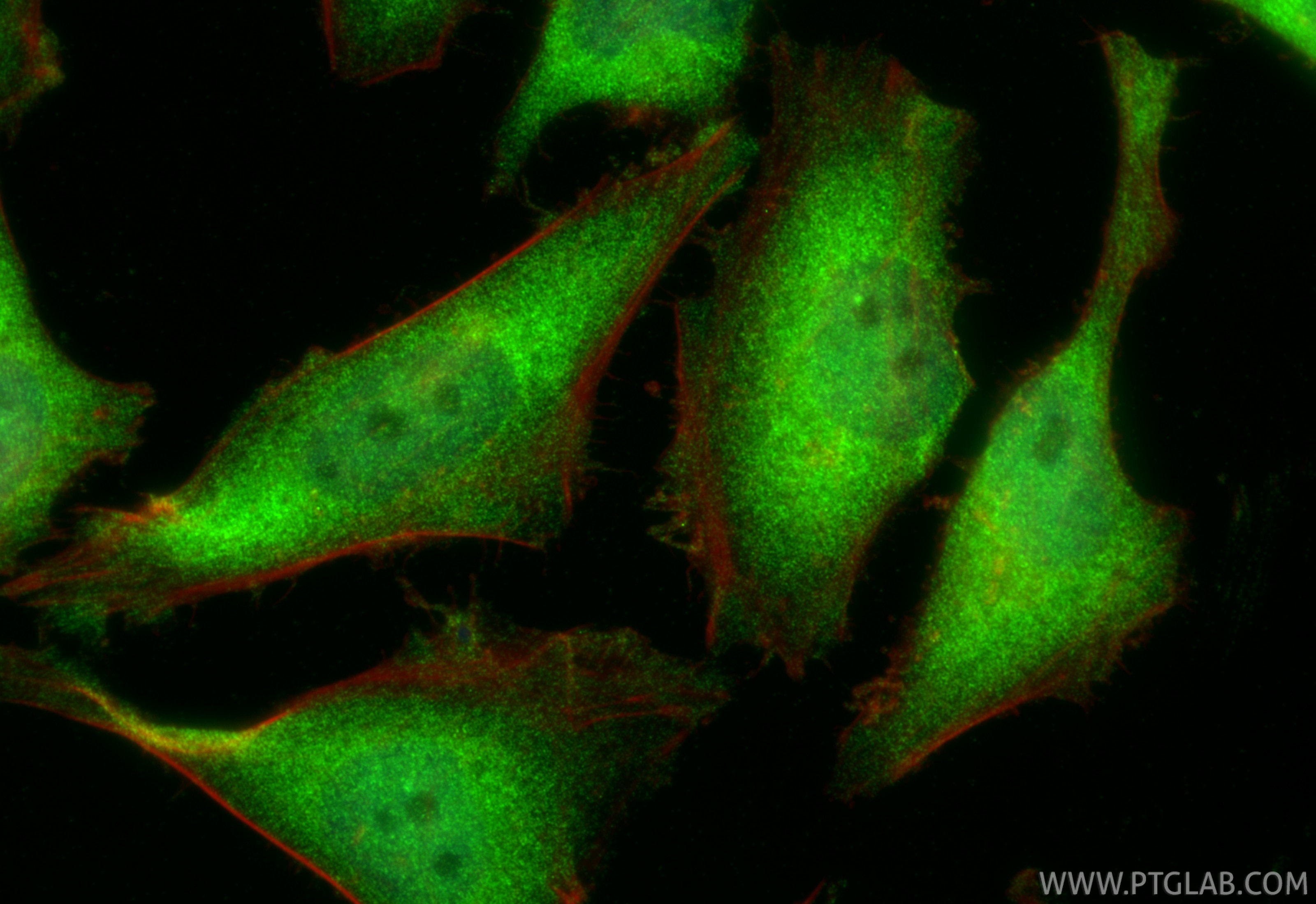 Immunofluorescence (IF) / fluorescent staining of HeLa cells using Multi-rAb® PRMT5 Multi-Recombinant antibody (RMX00051)