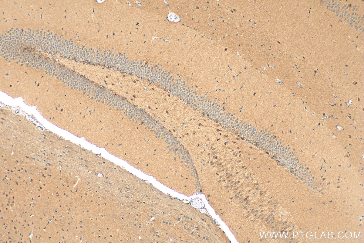Immunohistochemistry (IHC) staining of mouse brain tissue using Multi-rAb® PRMT5 Multi-Recombinant antibody (RMX00051)