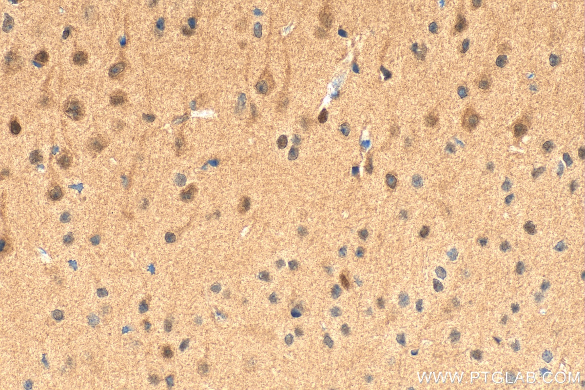 Immunohistochemistry (IHC) staining of mouse brain tissue using Multi-rAb® PRMT5 Multi-Recombinant antibody (RMX00051)