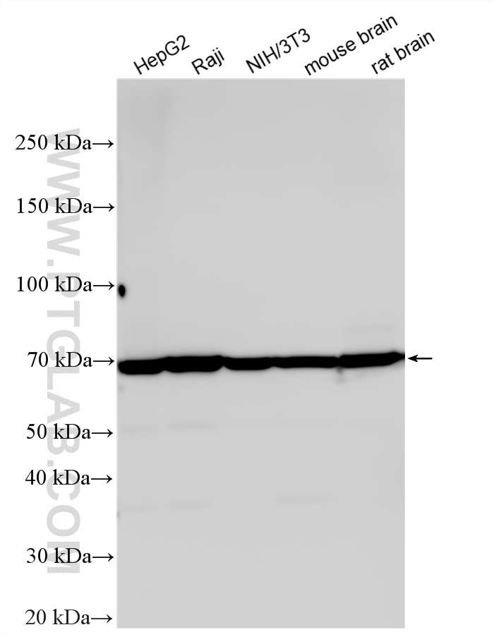 Western Blot (WB) analysis of various lysates using Multi-rAb® PRMT5 Multi-Recombinant antibody (RMX00051)