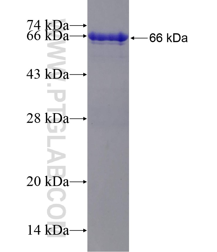 PRMT5 fusion protein Ag25896 SDS-PAGE