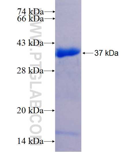 PRMT5 fusion protein Ag25901 SDS-PAGE