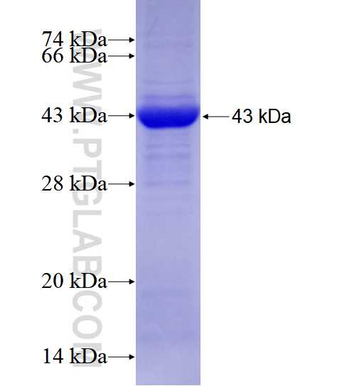 PRMT5 fusion protein Ag9678 SDS-PAGE