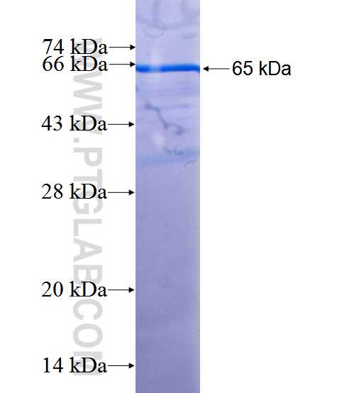 PRMT5 fusion protein Ag9736 SDS-PAGE