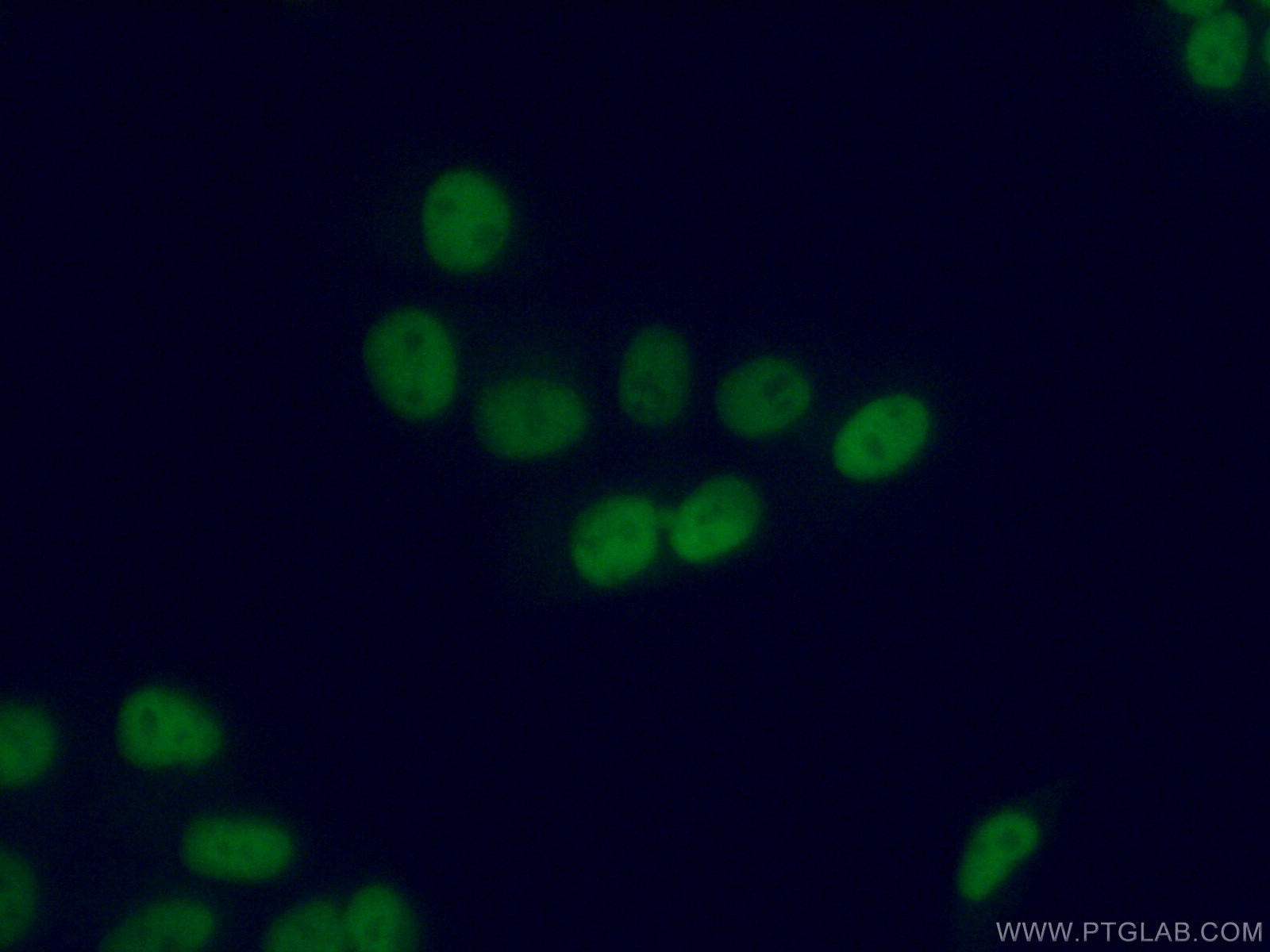 Immunofluorescence (IF) / fluorescent staining of MCF-7 cells using PRMT6 Polyclonal antibody (15395-1-AP)
