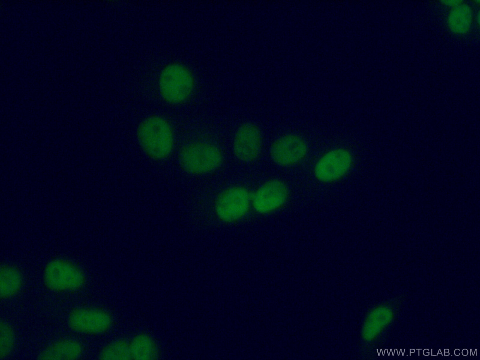 IF Staining of MCF-7 using 15395-1-AP